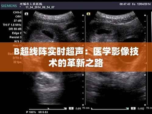 B超线阵实时超声:医学影像技术的革新之路