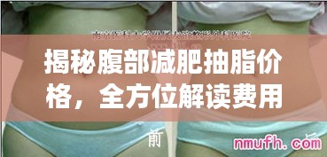 揭秘腹部减肥抽脂价格,全方位解读费用因素!